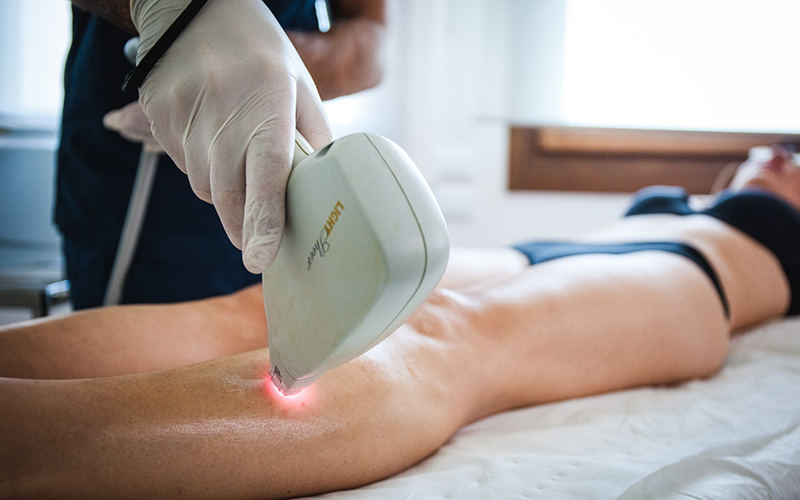 epilazione laser su cliente